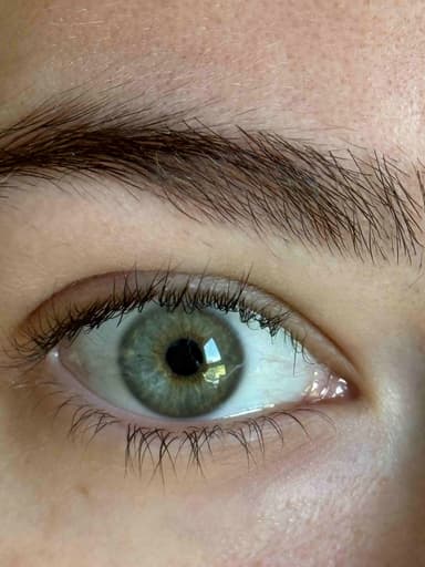 Before iris enhancement