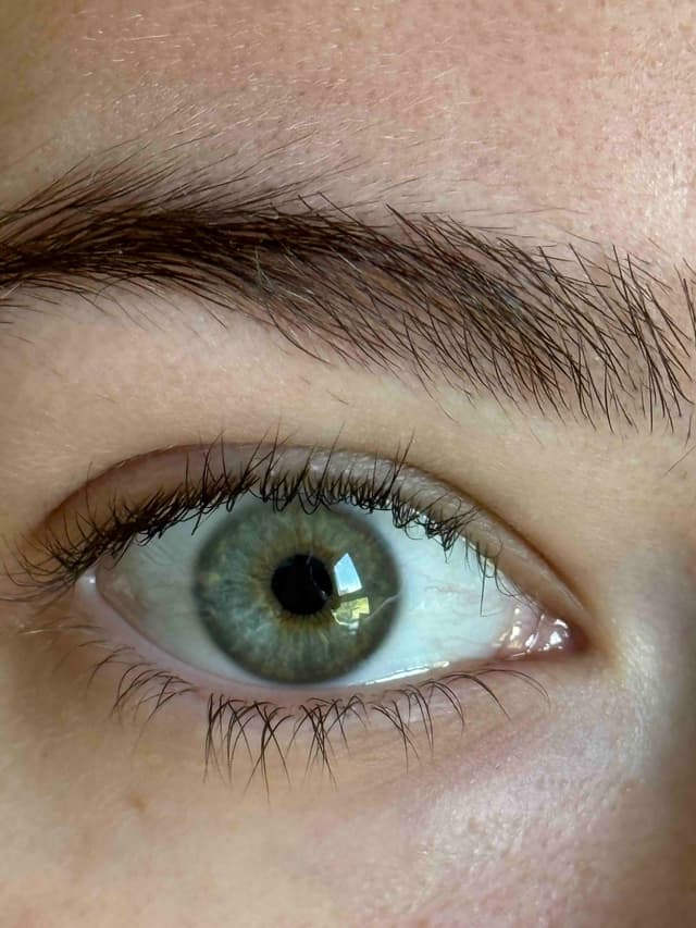 Before 2025 Enhancement